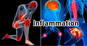 “Inflammation से राहत चाहिए? योग  के आसान उपाय जो अंदर से असर करते हैं!”